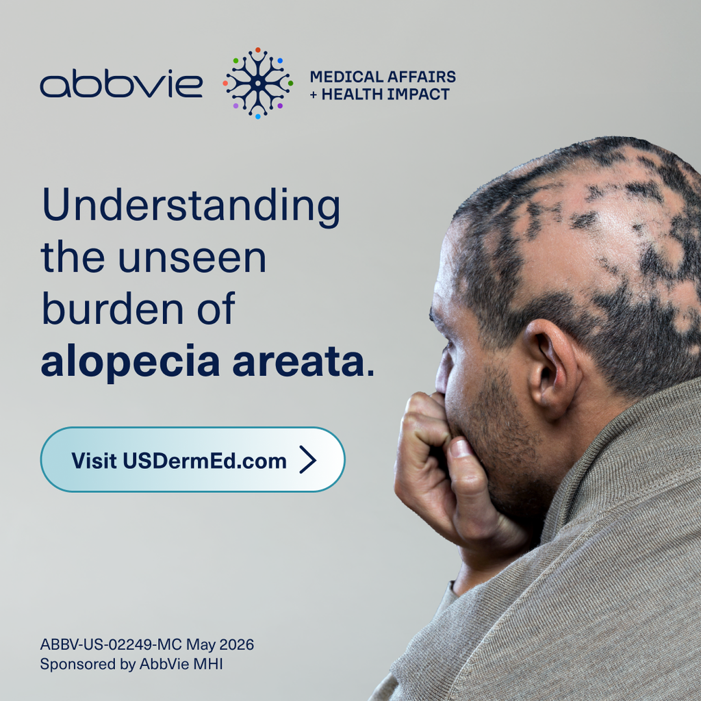Understanding the Unseen Burden of Alopecia Areata