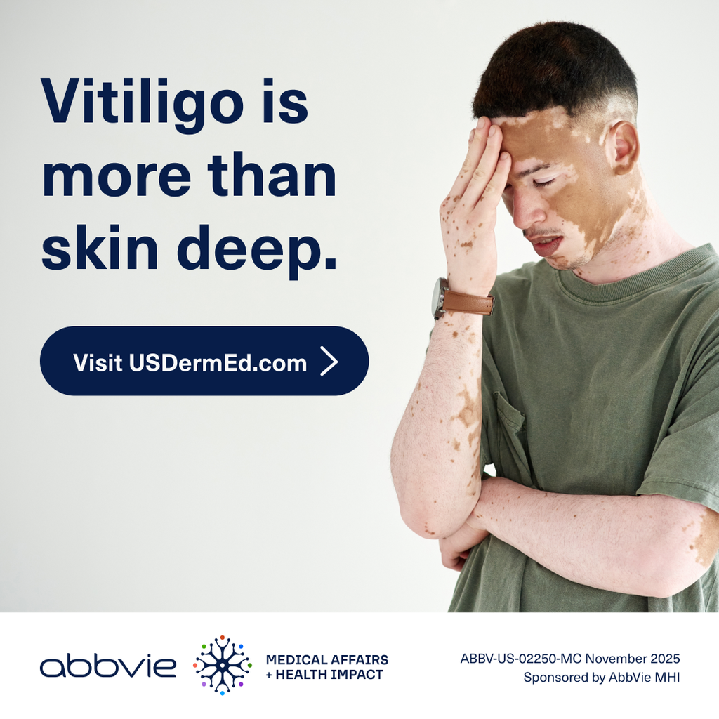 https://www.usdermed.com/vitiligo?cid=dis_dsa_vitiligo_banner_hcp_abbv-us-02250-mc_vitiligo_learnskin_webinar
