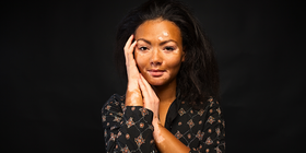 New Cover Photo - Emerging Therapeutic Options in Vitiligo Management